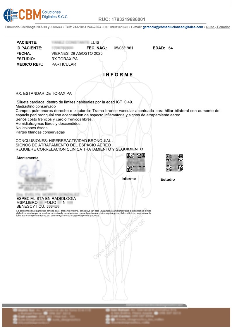 Informe