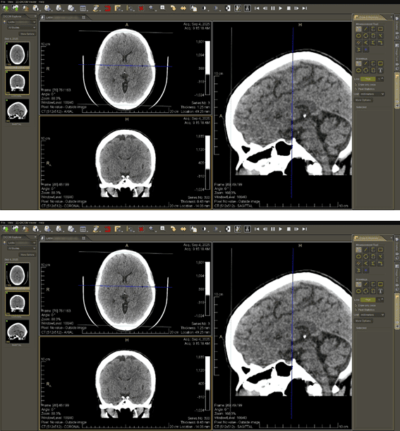 Visualizador DICOM